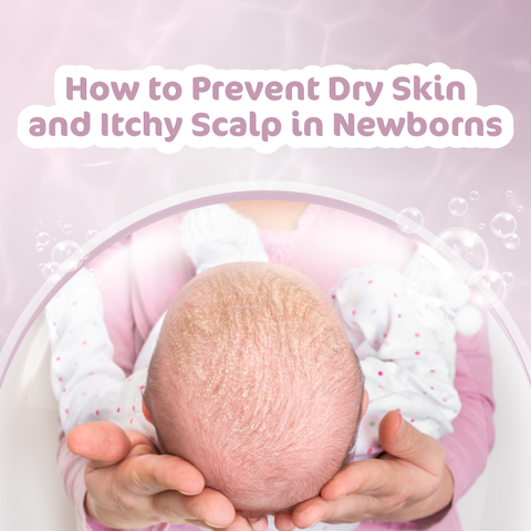 How to Prevent Dry Skin and Itchy Scalp in Newborns
